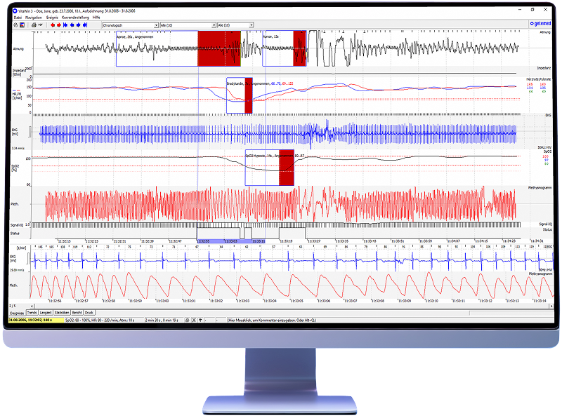 VitaWin 3.4 Auswertessoftware für VitaGuard Monitore