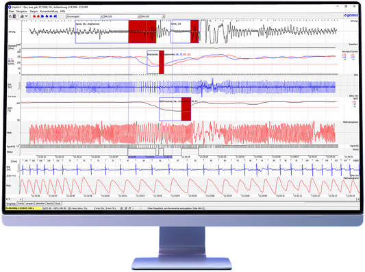 VitaWin 3.4 Auswertessoftware für VitaGuard Monitore